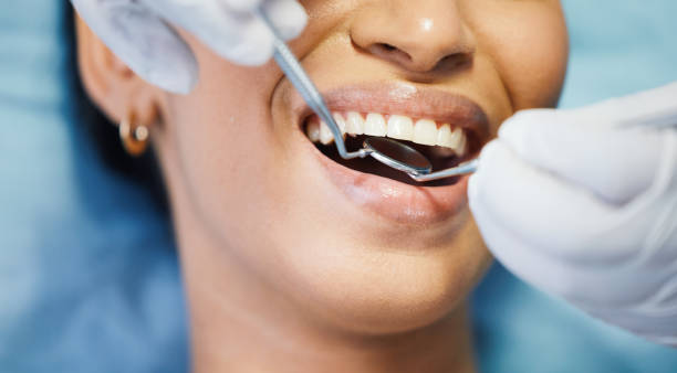 Best Emergency Dental Extractions in Wolcott, IN